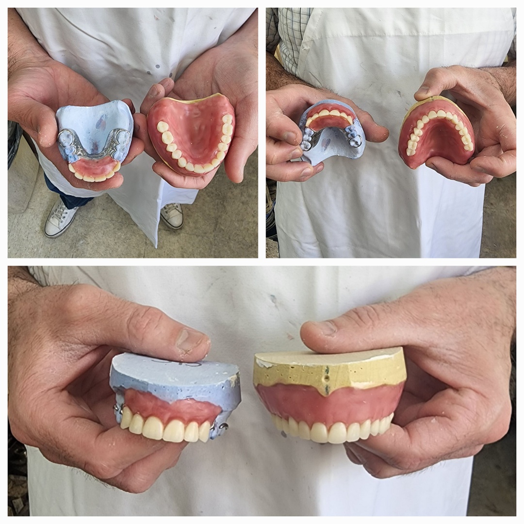 In-house dental lab at Dr. Hartman Dentistry